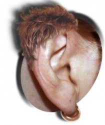 Googled earwig and this came up