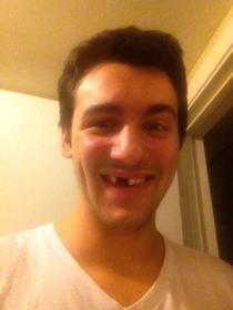 Got my teeth knocked out by some asshole who was possibly playing the knock out game I decided to make the best of the situation and post on reddit