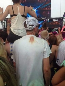 Grossest concert picture ever Period