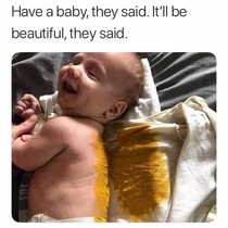 Have a baby they said
