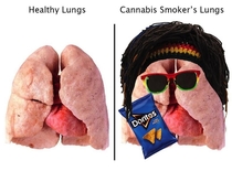 Healthy vs Cannabis Smoker Lungs