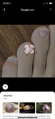 I asked Google Lens to tell me what these spots are on my toes The results cracked me up