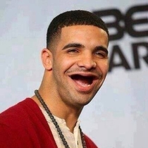 I cant stop laughing at Drake without teeth