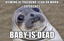 I naively asked the ultrasound technician why I couldnt see a heartbeat He had to take me out the room and explain the situation We then went back in and had to carry on as if everything was OK