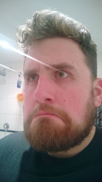 I tried to take a photo of my beard Suddenly lasers