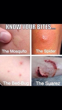Know your bites