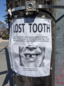 Lost Tooth