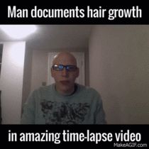 Man Documents Hair Growth in Time Lapse Kind of