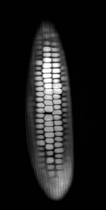 MRI of a corn cob
