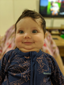 My baby daughter high on milk after a feed