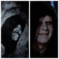 My babys ultrasound or Darth kidious