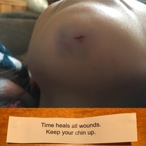 My daughter injured her chin today and at dinner received this fortune cookie