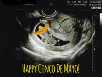 My fianc and I had our ultrasound on  but because of the quarantine we couldnt celebrate So I made this She did not find it as humorous as I did