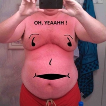 My friend sent a pic of his sunburn Couldnt resist