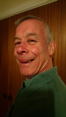 My gfs dad got stung on the nose and lip and now he looks like the Grinch
