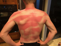 My Wife helped me sunscreen my back at beach day today TWICE