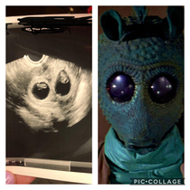 My wifes ultrasound twins reminded me of something