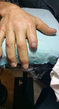 Nailed it Tattoo artist fixed his uncles amputated finger