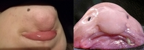 Noticed my SOs chin bears a striking resemblance to a certain sea creature