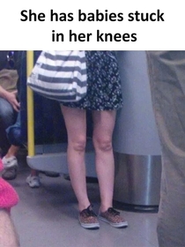 She has Babies stuck in her knees