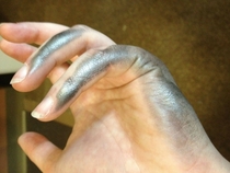 Silver Surfer Syndrome Left Handed Problems