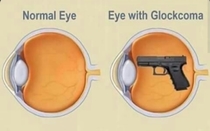 So THATS why my sight sucks