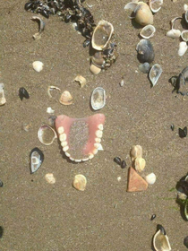 Someone didnt have a good day at the beach Theres a whole funny story behind these teeth I just know it amp its killin me