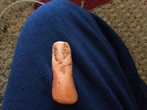 Someone lost a finger at the carrot factory