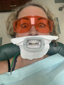 The pic my mom sent me at the dentist
