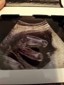 Thought my friends sonogram was a new Jurassic Park poster