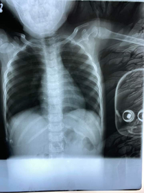 To get x-ray with your doll
