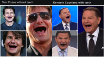 To the one who posted Tom Cruise without teeth I raise you Kenneth Copeland with teeth