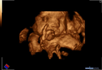 Ultrasound baby smoking a blunt