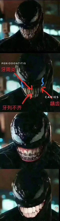 Venom needs to get his teeth fixed