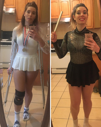 Was on Crutches Last Halloween amp Went as Nancy Kerrigan - This Year Obviously Had to be Tonya Harding