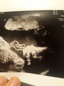 Went for a baby scan todaywe already have a boy an a girl and the third is going to b aem dinosaur