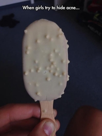 When Girls Try To Hide Acne