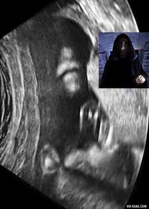 When your baby is born as a sith
