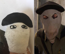 Who wore it better My toe or CSGO terrorists